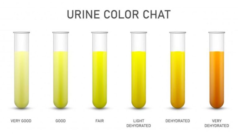 Yellow Pee Is A Good Indication For Your Healthy Status – Daily Detroit 