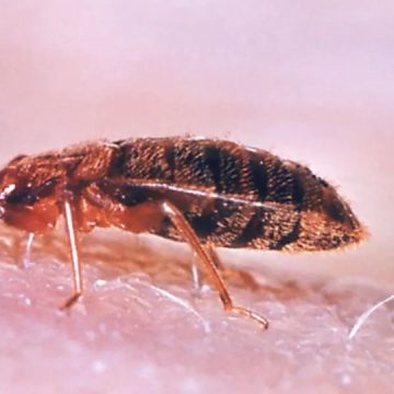 3 New Jersey Cities Crawling With Most Infested Bed Bugs in 2024